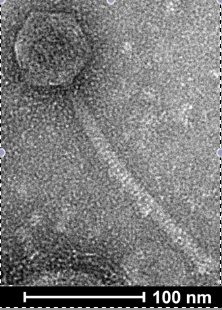 Imagen micrográfica electrónica de un fago con una escala marcada en la parte inferior de 100 nanómetros.