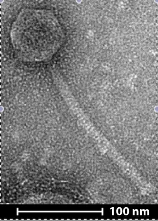 Imagen micrográfica electrónica de un fago con una escala marcada en la parte inferior de 100 nanómetros.